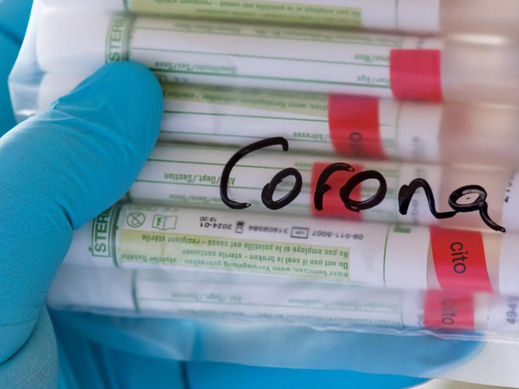 Coronavirus - Test | © Hendrik Schmidt